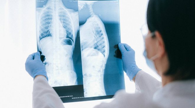 Vaccini e cronicità respiratoria: benefici in BPCO e asma secondo le ultime evidenze